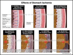 figure4-effects-of-stomach-ischemia-r31408-08x