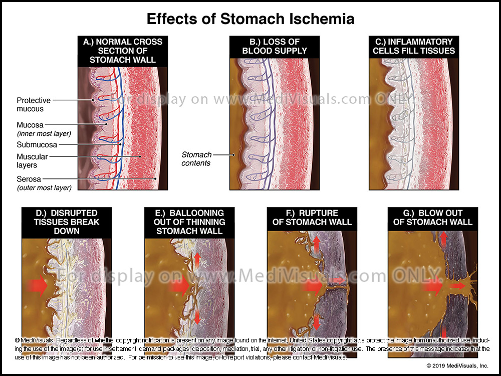 figure4-effects-of-stomach-ischemia-r31408-08x