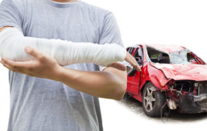 Circumstances of Your Case Impacting Recovery Time circumstances of your case impacting when you can recover
