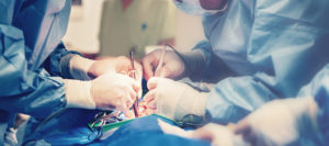Foreign Objects Left in Patients During Surgery | Maggiano, DiGirolamo & Lizzi P.C. foreign objects left in patients during surgery