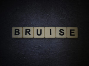 Forr Lee Scrapes, Bruises, and Lacerations Lawyers | Nursing Home Abuse | Maggiano, DiGirolamo & Lizzi P.C. Forr Lee Scrapes, Bruises, and Lacerations Lawyer