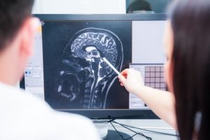 Fort Lee Traumatic Brain Injury Lawyers Maggiano, DiGirolamo & Lizzi P.C. traumatic-brain-injury-lawyer