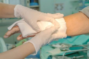 Fair Lawn Burn Injuries Lawyers | Maggiano, DiGirolamo & Lizzi P.C. Fair Lawn Burn Injuries Lawyers