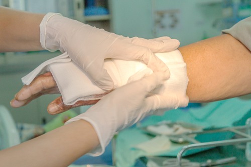 Fair Lawn Burn Injuries Lawyers