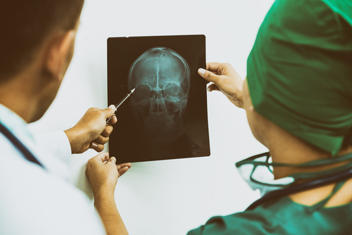 how much is a head injury claim worth
